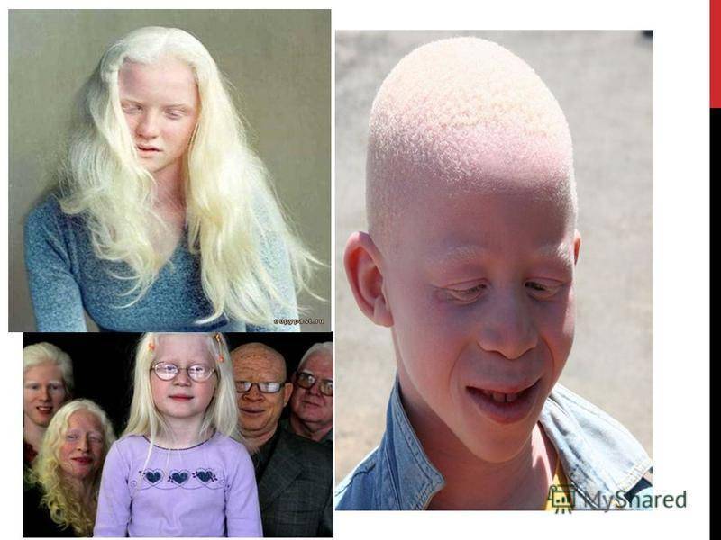 Что нужно знать, если завести белого добермана-альбиноса. как выглядит белый доберман: особенности характера и основные правила ухода