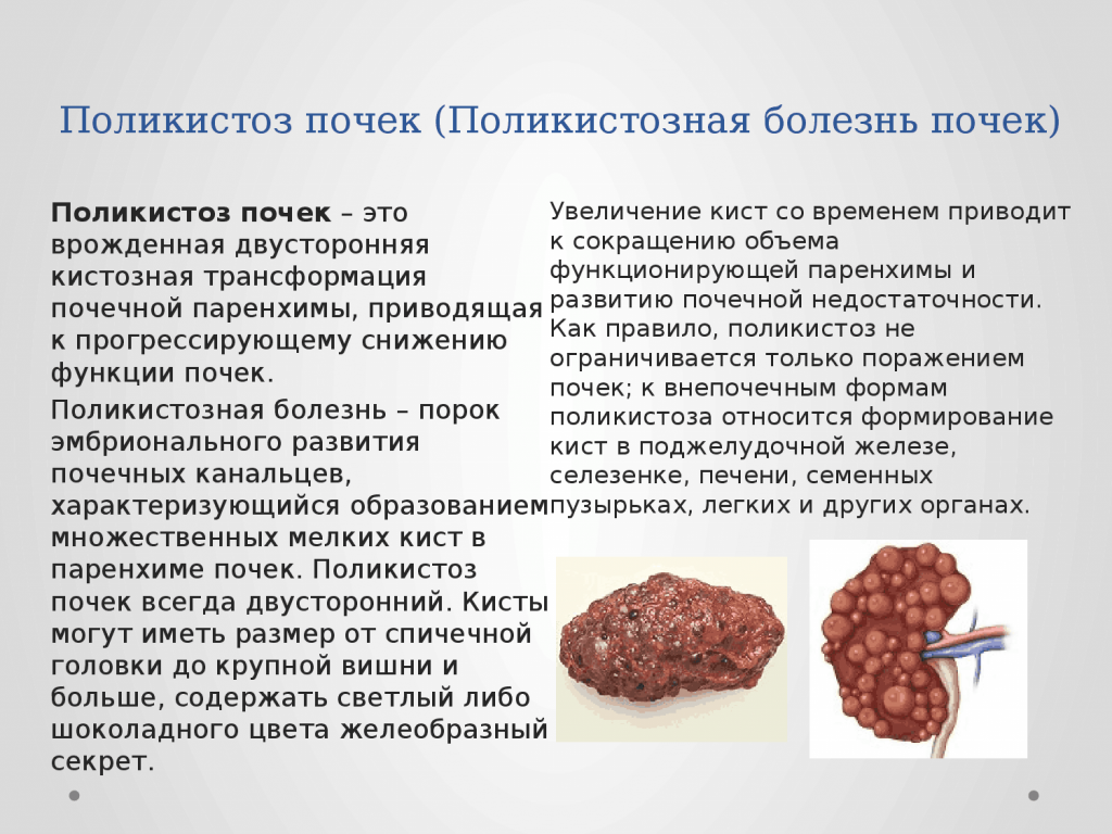 Поликистоз: как справиться с распространенной женской проблемой?