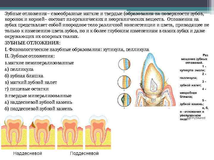 Зубной камень — причины, симптомы, лечение и профилактика | стоматология 24