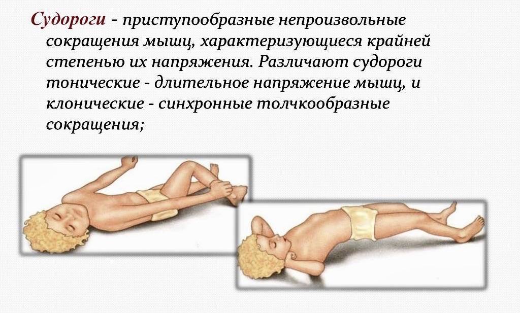 Судороги у кошек: 110 фото и видео советы что делать при проявлении первых симптомов