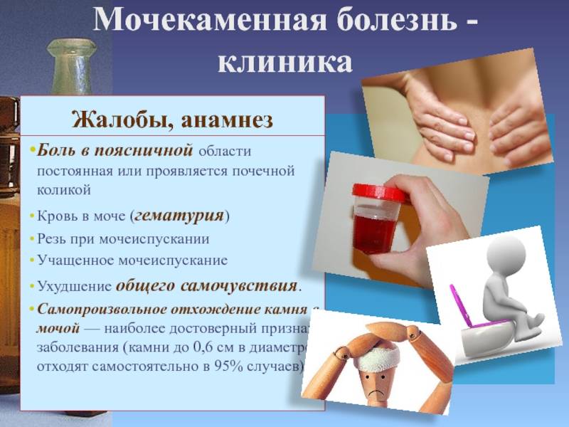 Мочекаменная болезнь у детей