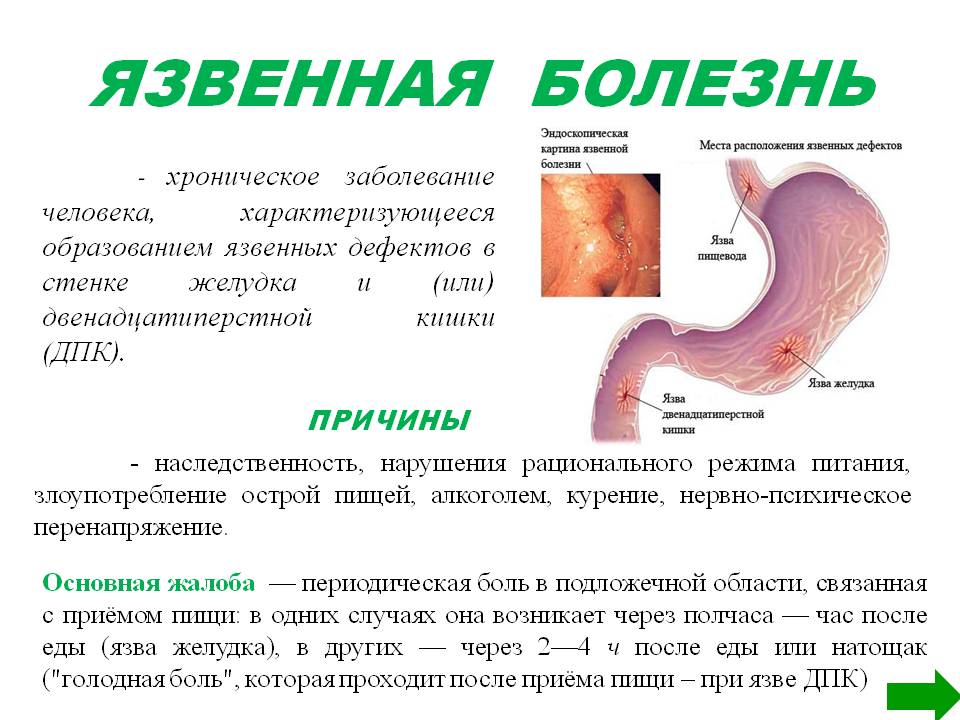 Язва желудка у собак - симптомы, диагностика и лечение заболевания