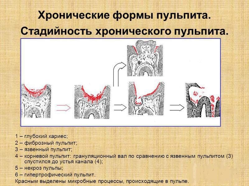 Стоматит у котенка, кота и кошки: симптомы и лечение, опасности, разновидности патологии