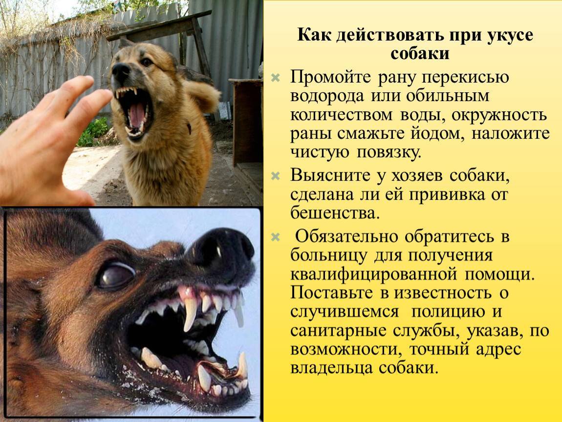 Укусила собака, куда обращаться, к какому врачу