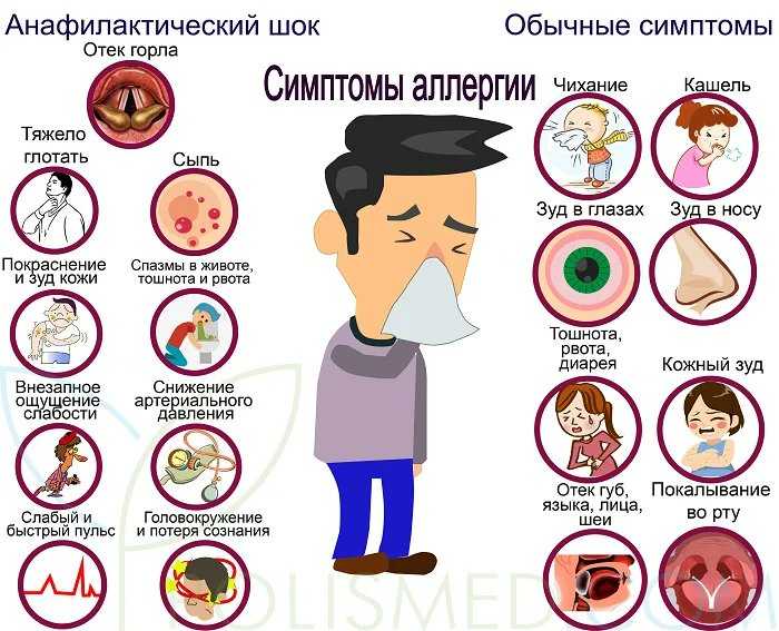 Симптомы аллергии на грибок и плесень: всё, что вам нужно знать