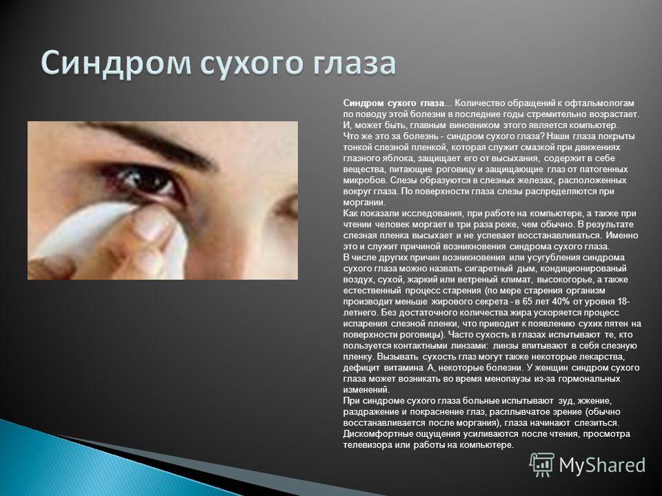 Заболевания конъюнктивы: диагностика и лечение