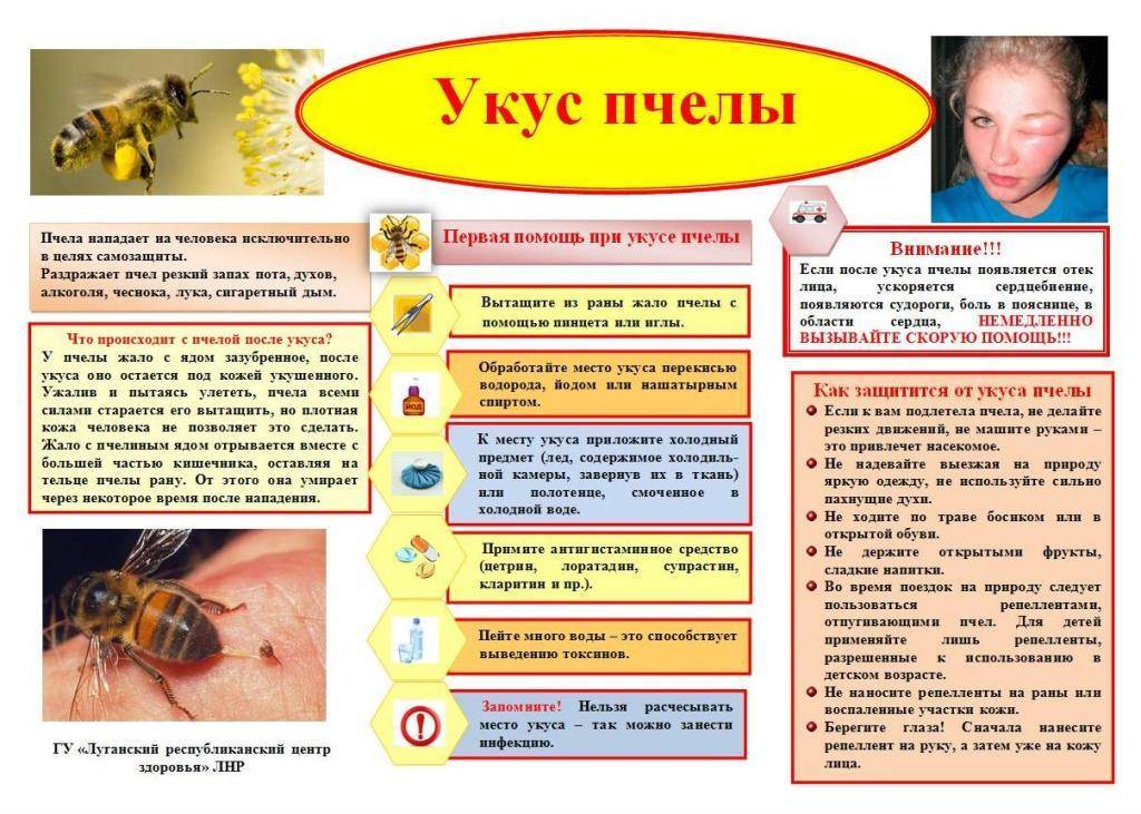 Нормальная и аллергическая реакция на укусы жалящих насекомых - медицинская энциклопедия