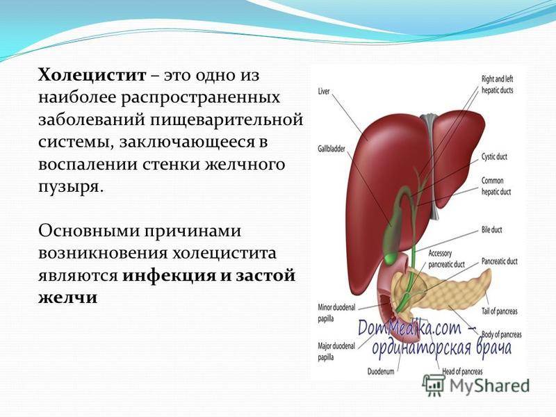 Холецистит первичное заболевание билиарной системы