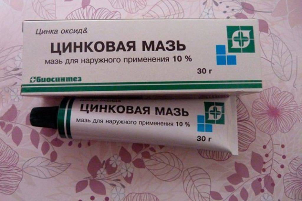 Стригущий лишай