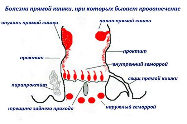 Кровь в стуле котят: причины и методы лечения