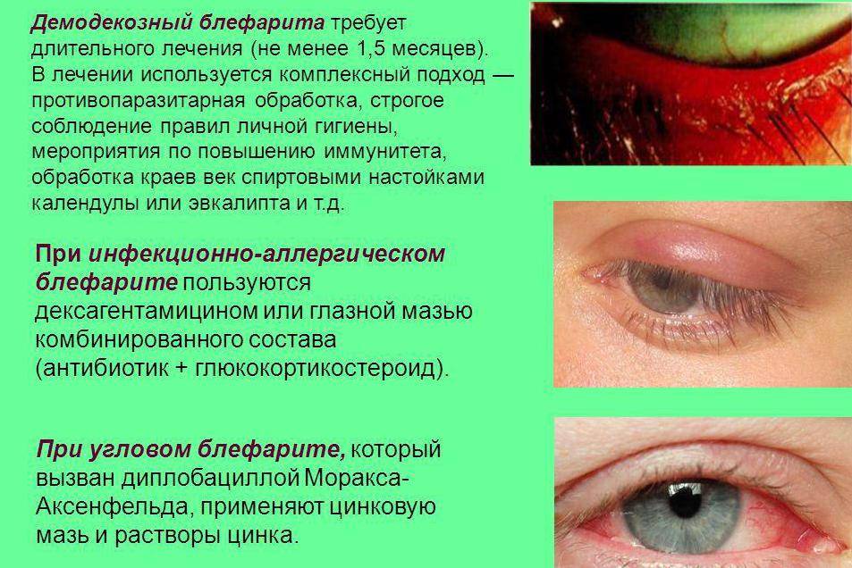 У кроликов гноятся глаза: причины и лечение в домашних условиях