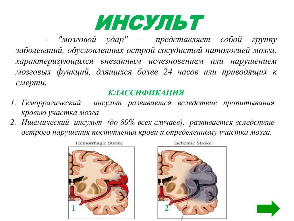 Инсульт у кошек и котов: симптомы и лечение