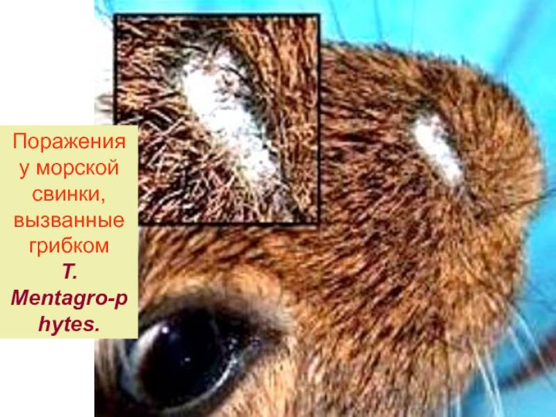 Цветной лишай: причины появления и лечение * клиника диана в санкт-петербурге