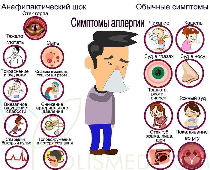 Аллергия на морскую свинку у детей и взрослых: симптомы и лечение