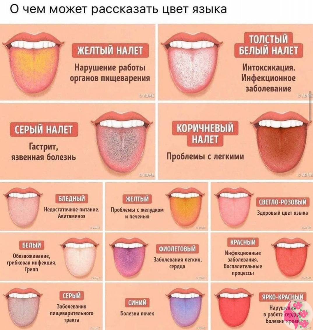 Головная боль и тошнота: причины, симптомы, диагностика и лечение | ким