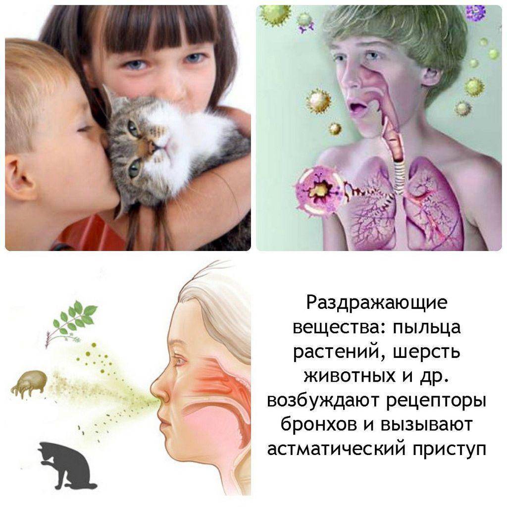 Аллергия у детей – виды, причины, симптомы и эффективное лечение