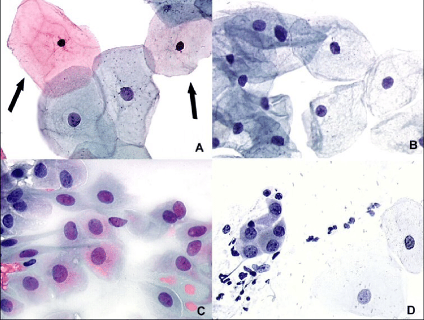 Паракератоз в мазке на цитологию что. Цитологическое исследование эпителия шейки матки. Цитология мазка шейки матки. Цитология эпителий влагалища. Цитологическое исследование гинекологических мазков.