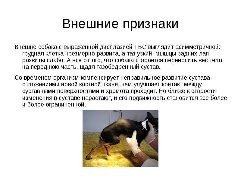 Дисплазия тазобедренных суставов у детей