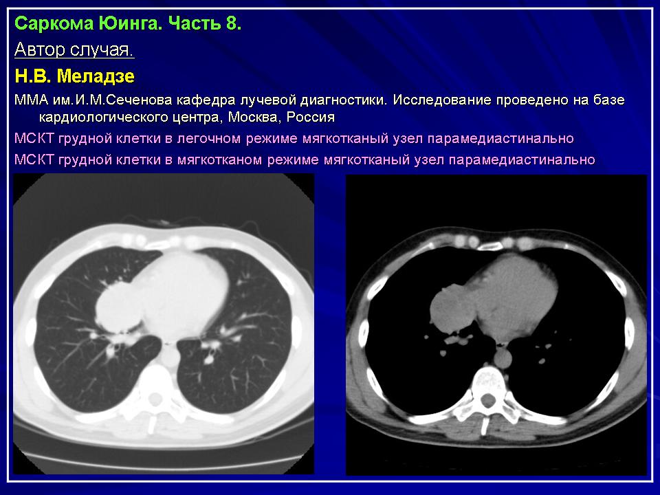 Трансмиссивная саркома › белый клык
