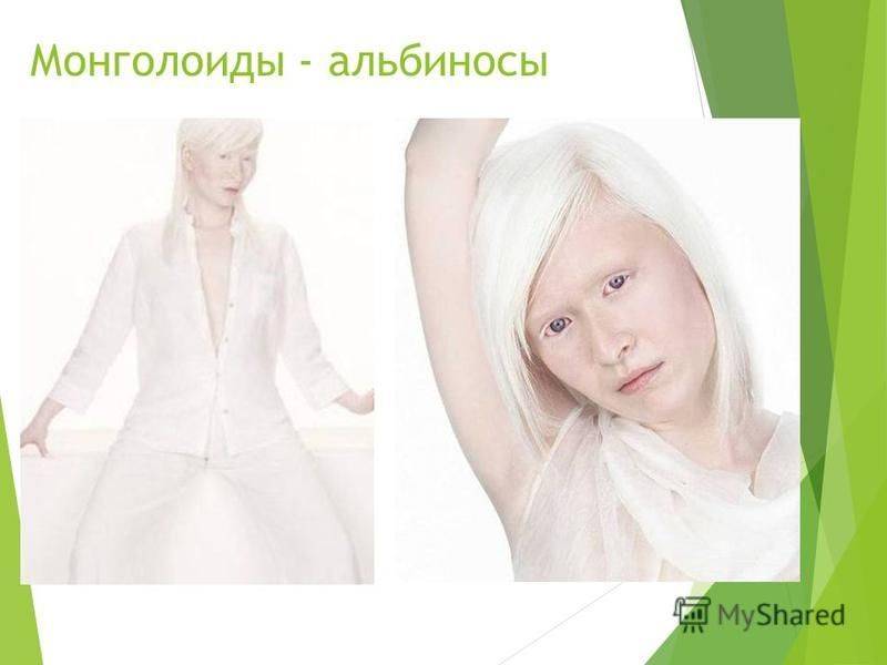 Животные-альбиносы: фото и описания редких видов