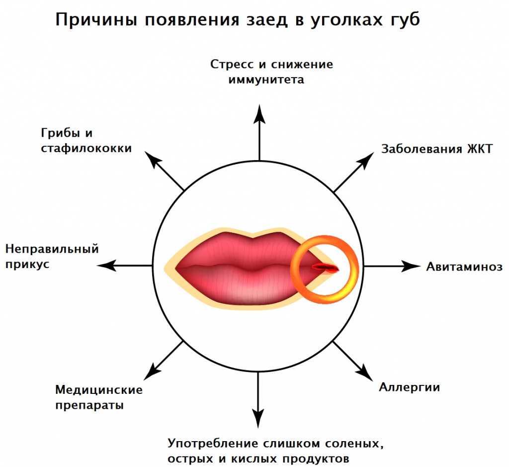 Рак губы: симптомы, первые признаки рака губы, как выглядит рак губы на начальной стадии, причины рака губы | клиники «евроонко»