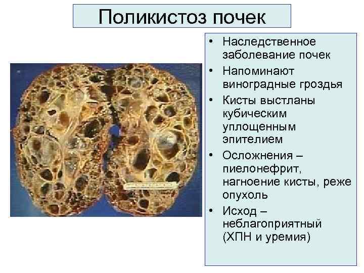 Поликистоз почек у кошек: ранняя диагностика, лечение, прогноз