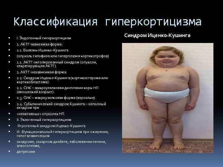 Синдром иценко-кушинга: лечение, диагностика, патогенез, симптомы, рекомендации