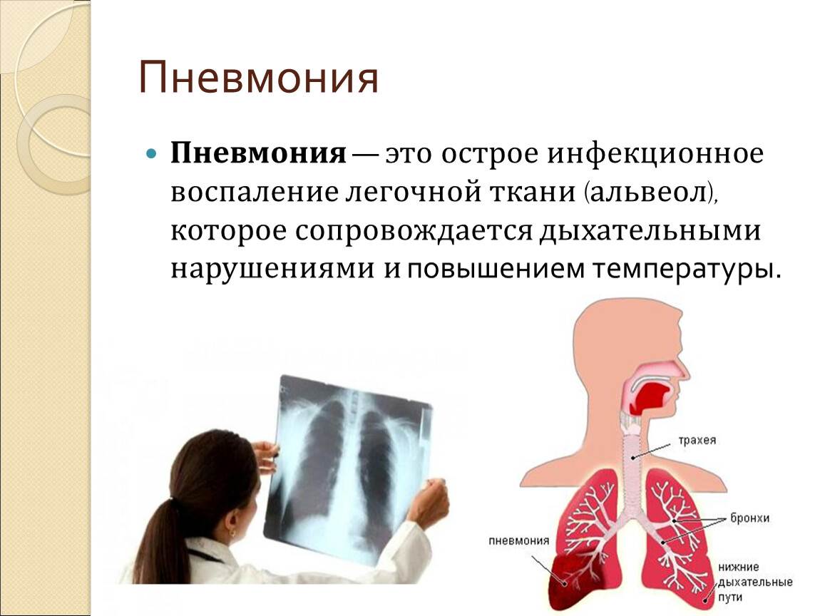 Инфекция легких лечение. Передается ли вирусная пневмония воздушно капельным. Передаётся ли пневмония от больного воздушно капельным. Сообщение про болезни органов дыхания пневмония. Пневмония это инфекционное заболевание.