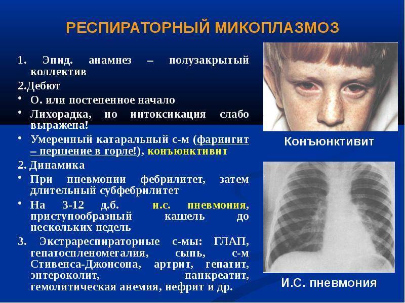 Микоплазмоз у крыс: симптомы, лечение и профилактика