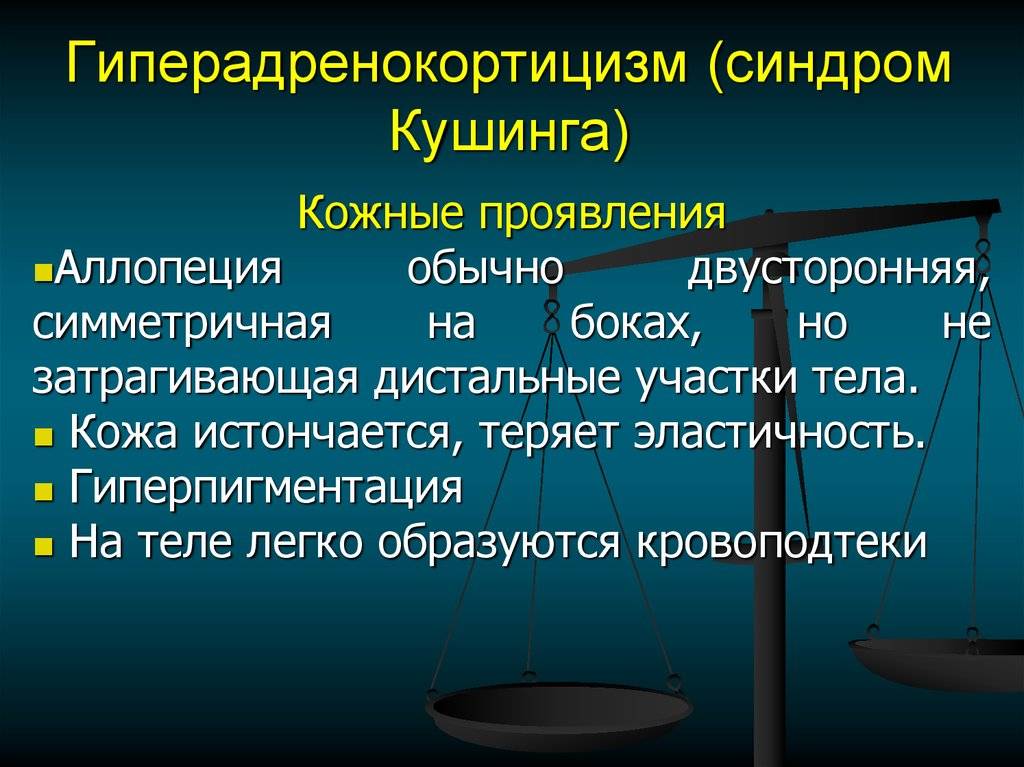 Признаки, причины и методы лечения гиперадренокортицизма