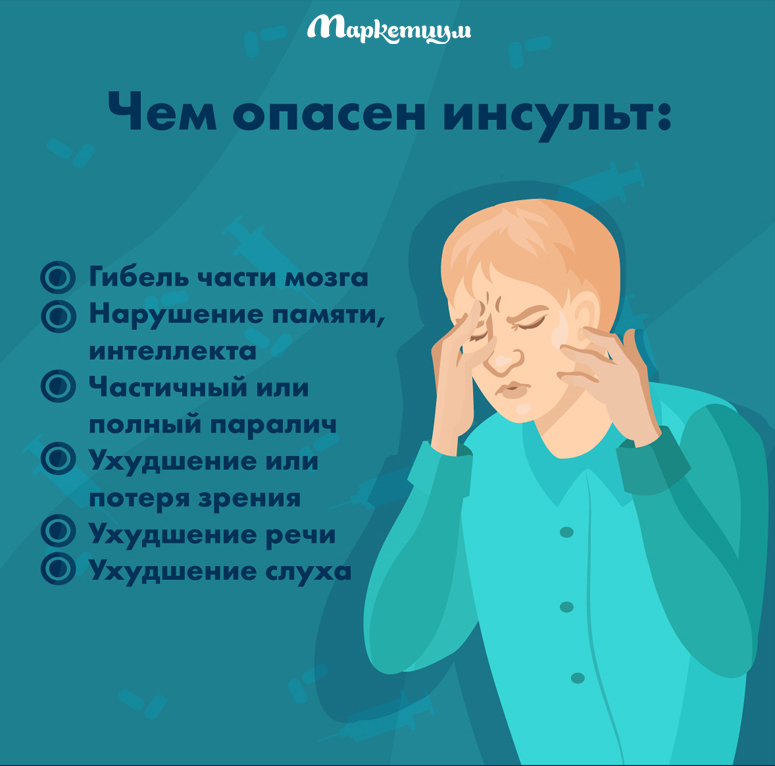 Инсульт можно не заметить