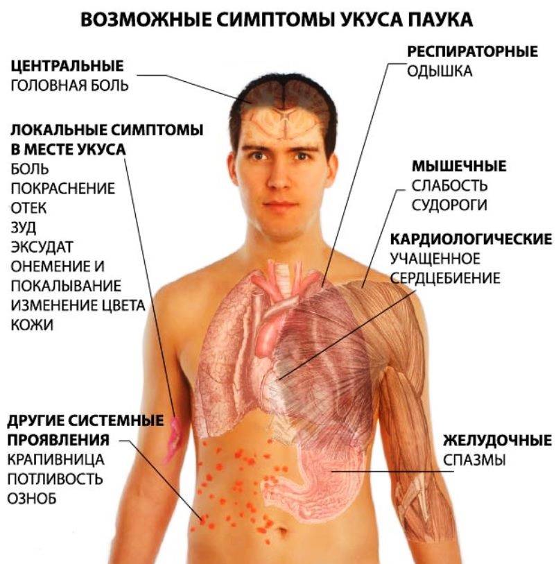Болезнь рейтера