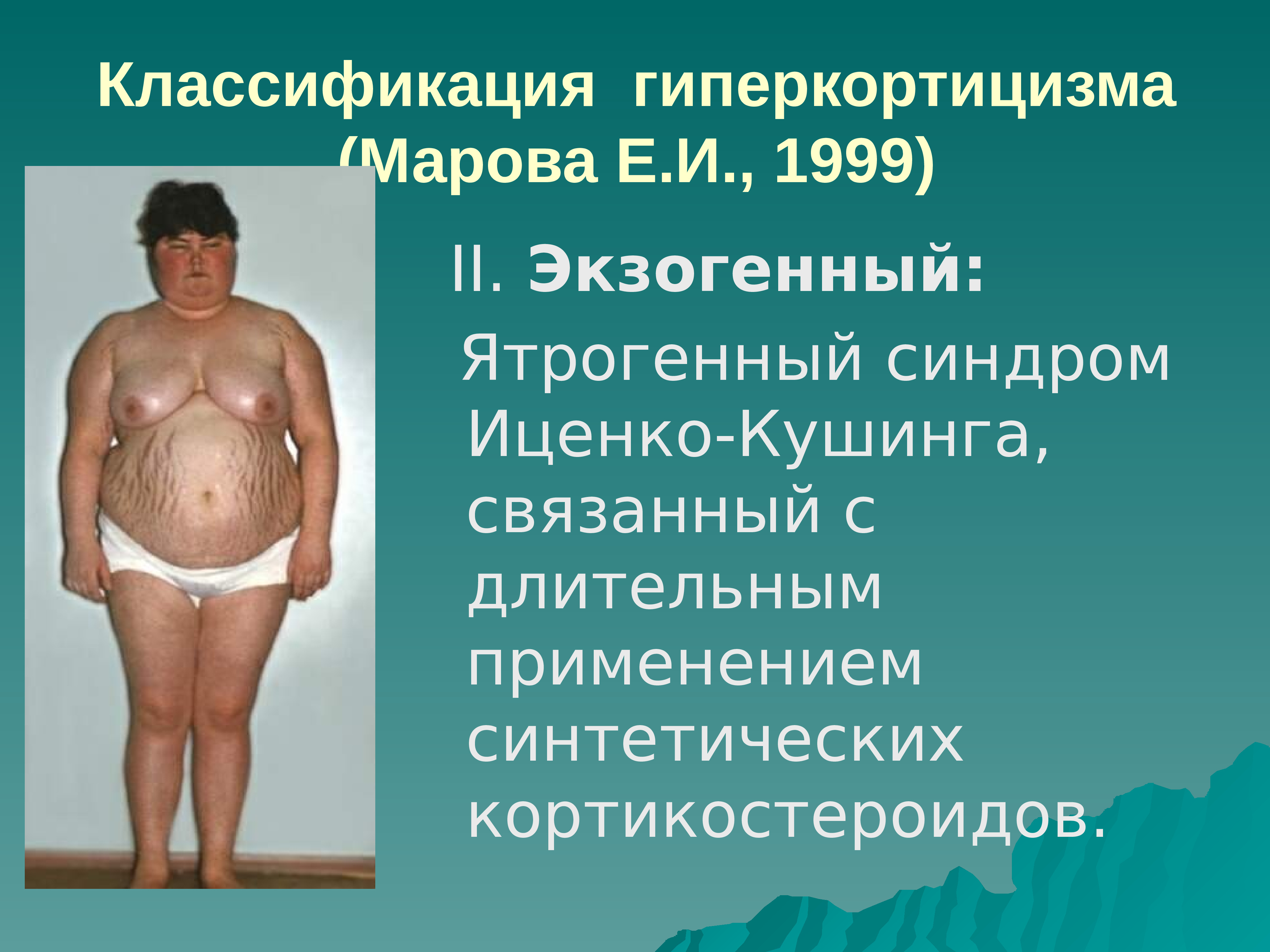 Болезнь иценко - кушинга