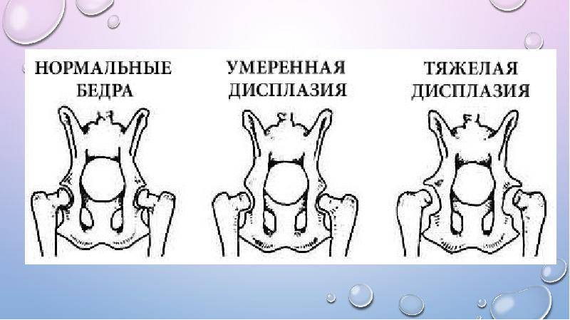 Дисплазия тазобедренных суставов у собак