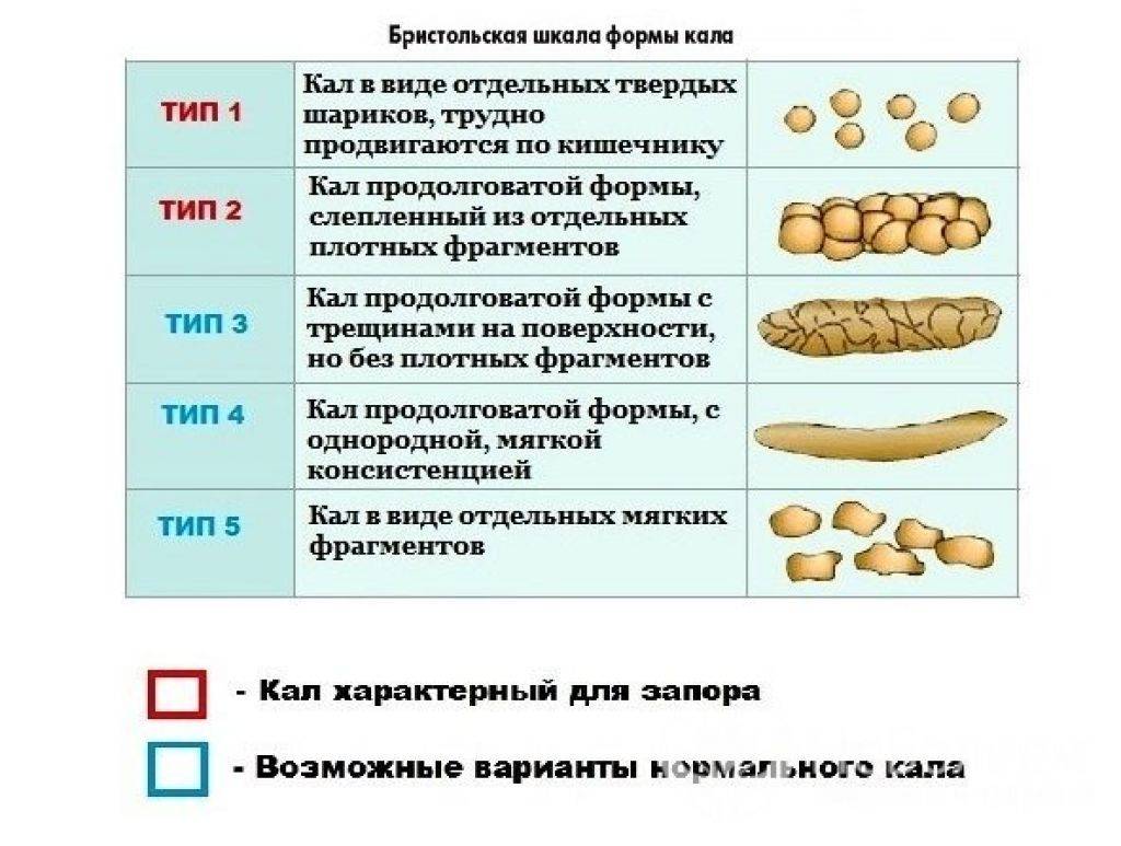 Хронический запор