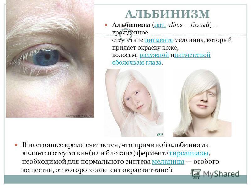 Доберман альбинос – чудо природы |