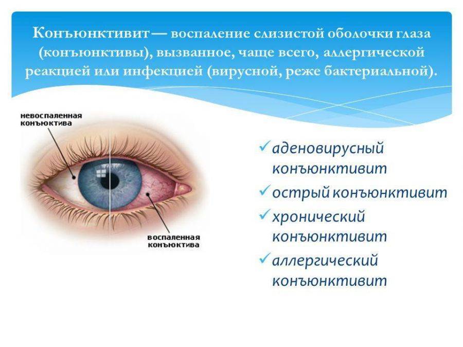 Заболевания глаз у хомяков