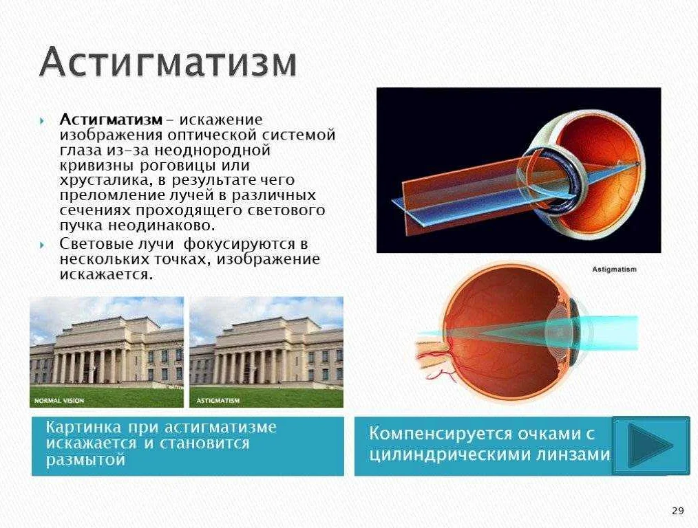 Стал хуже видеть один глаз размытое изображение что делать