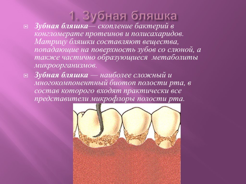 Так ли опасен зубной камень?