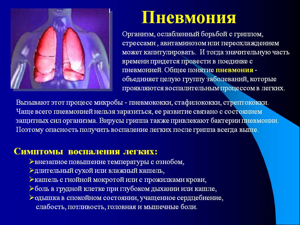 Презентация воспаление легких