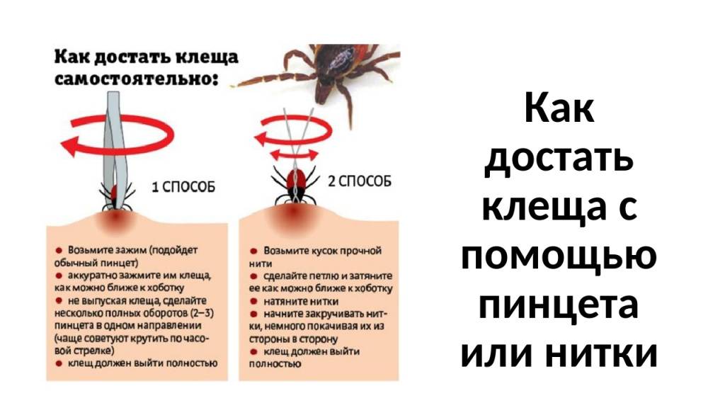 2 проверенных способа как снять кота с высокого дерева, если она уже долго там сидит
