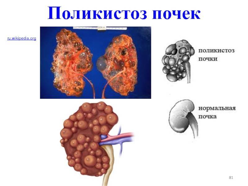 Болезни почек у кошек. хроническая болезнь почек (хбп).