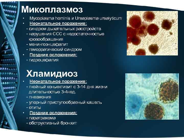 Уреаплазмоз, микоплазмоз. причины заражения, симптомы, лечение уреаплазмоза и микоплазмоза.