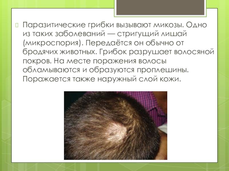 Стригущий лишай * клиника диана в санкт-петербурге