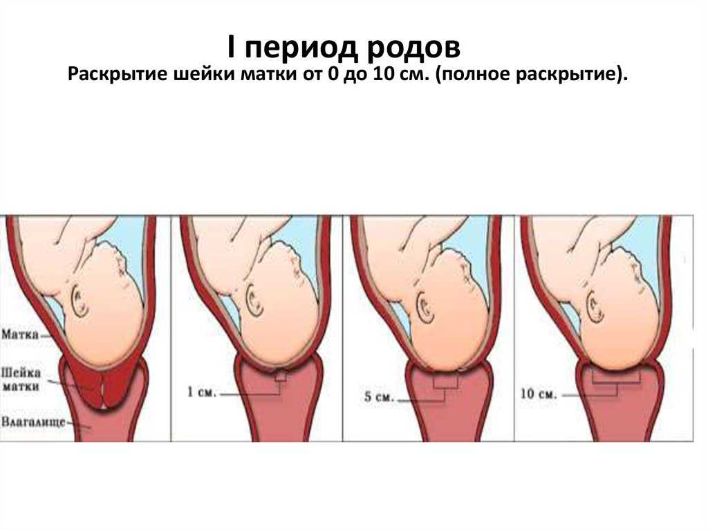 Первые признаки родов: как распознать начало родовых болей