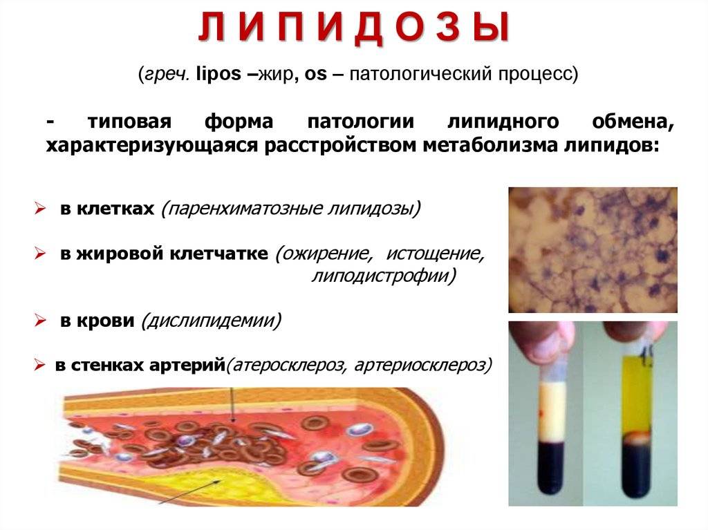 Фосфоглив при жировом гепатозе: лечение гепатоза лекарственным препаратом