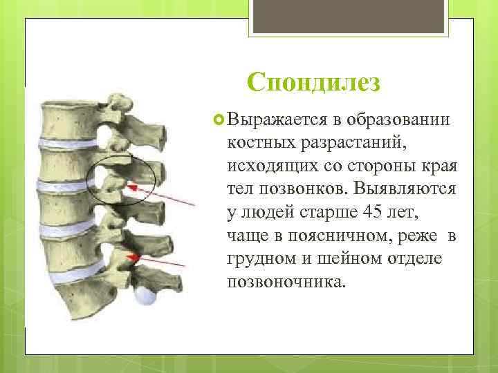 Действительно ли спондилезом болеют только собаки в возрасте?