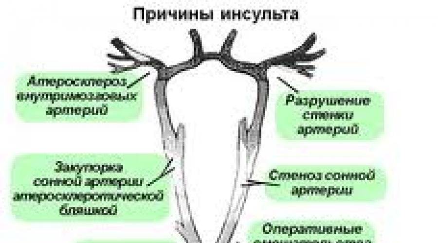 Инсульт мозга: ишемический, геморрагический, лечение, реабилитация