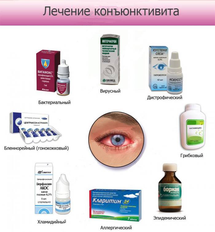 Конъюнктивит у кроликов