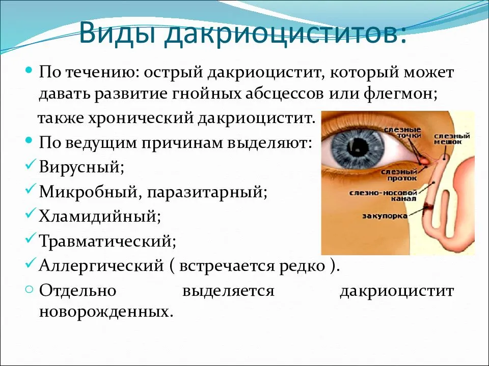 Что такое гнойный конъюнктивит глаз? - энциклопедия ochkov.net